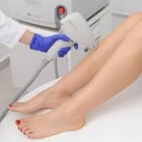 Maszyna do depilacji i nogi